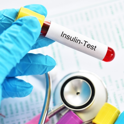 SpeedMedical - Inzulinrezisztencia SpeedMedical - Inzulinrezisztencia